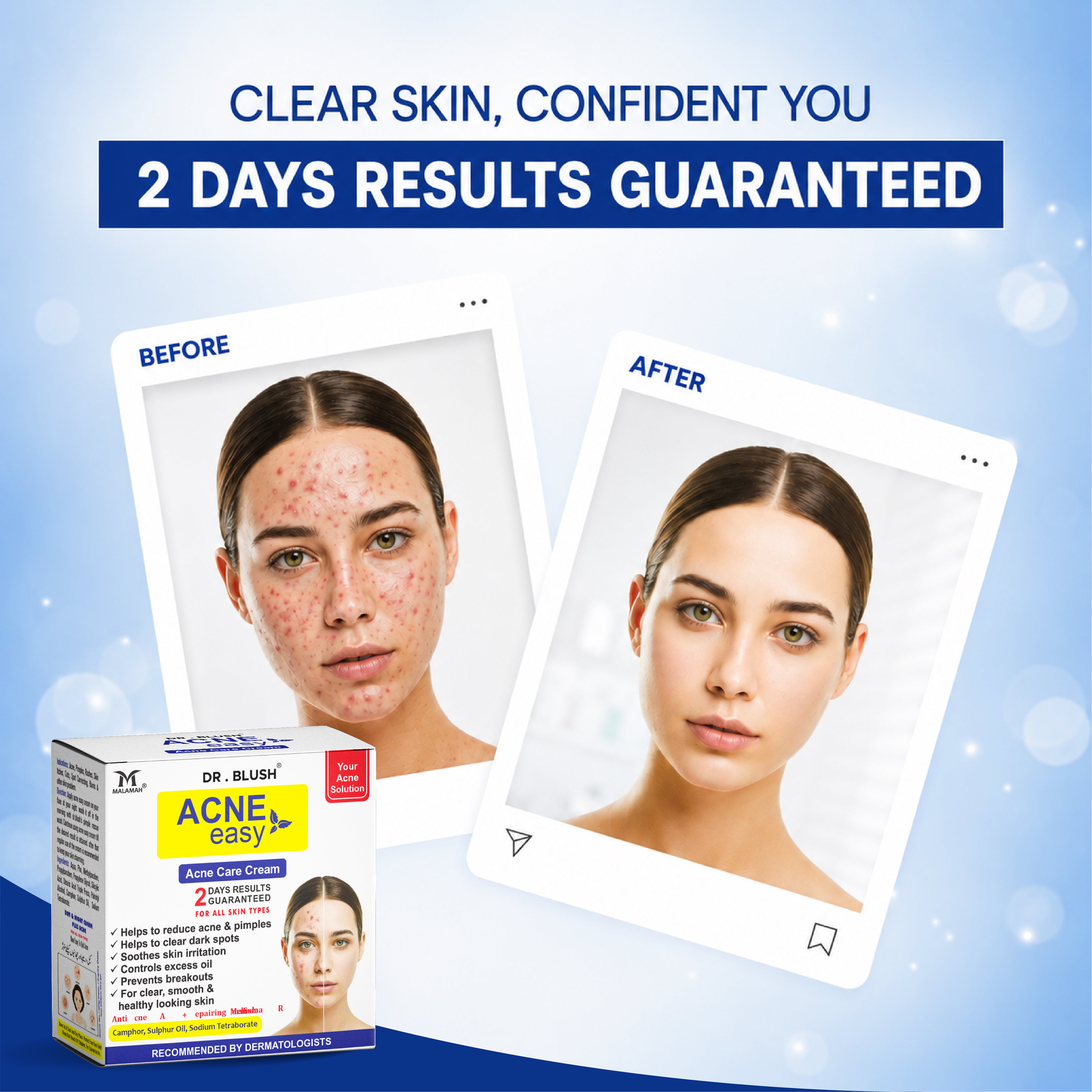 Dr blush Acne Easy (pimple cream)18g